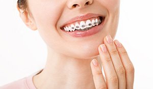 Close-up of young woman’s smile with braces