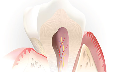 Cartoon depiction of inside of tooth