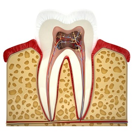 A root canal in Richardson